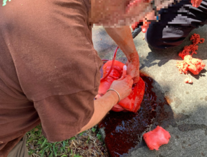 STOP THE BLEED - Image 6